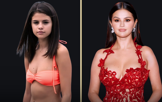 Selena Gomez Plastic Surgery: Did Selena Gomez Have Plastic Surgery?